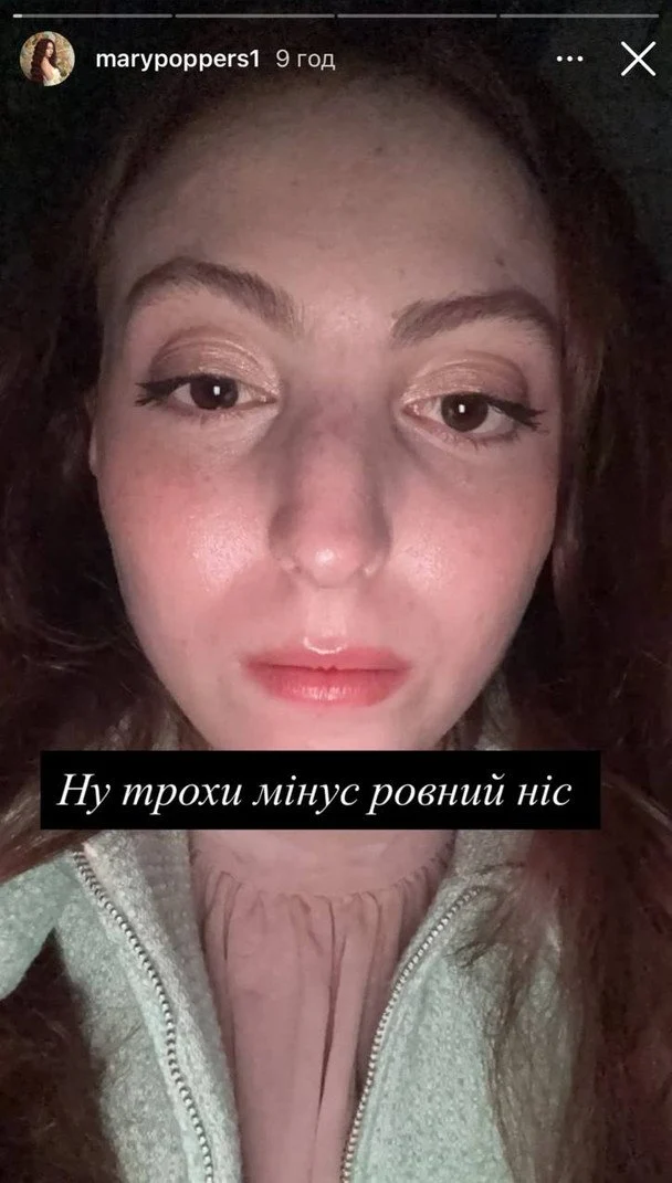 Маша Полякова після ДТП / © instagram.com/marypoppers1