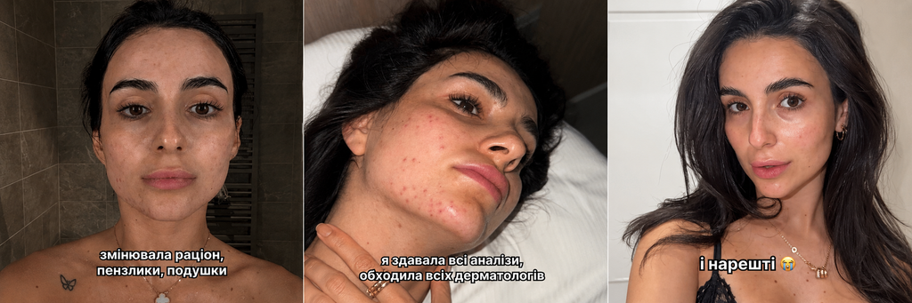 Анна Трінчер