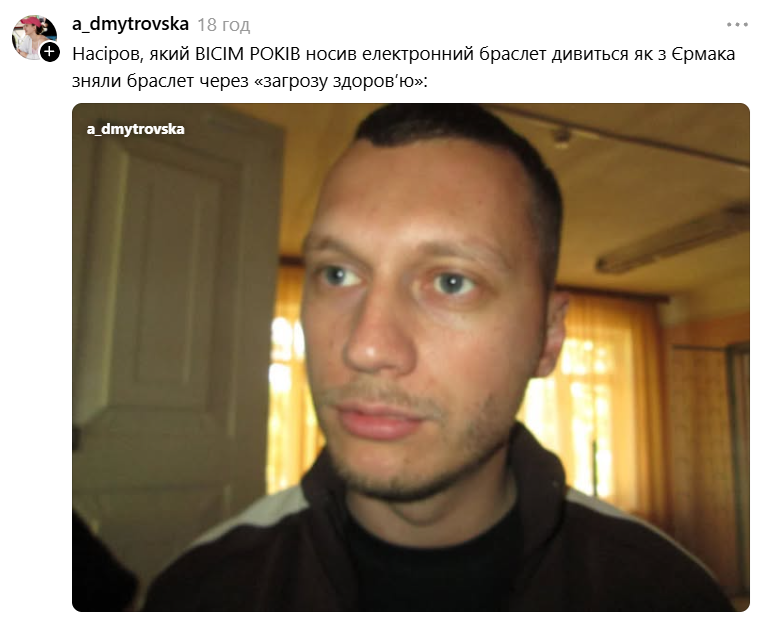 Андрій Єрмак зняв електронний браслет 'за станом здоров’я', а українці створили меми про це